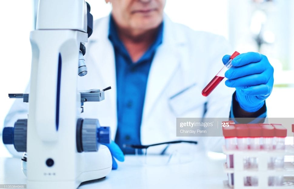 Closeup shot of a scientist analyzing samples in a laboratory